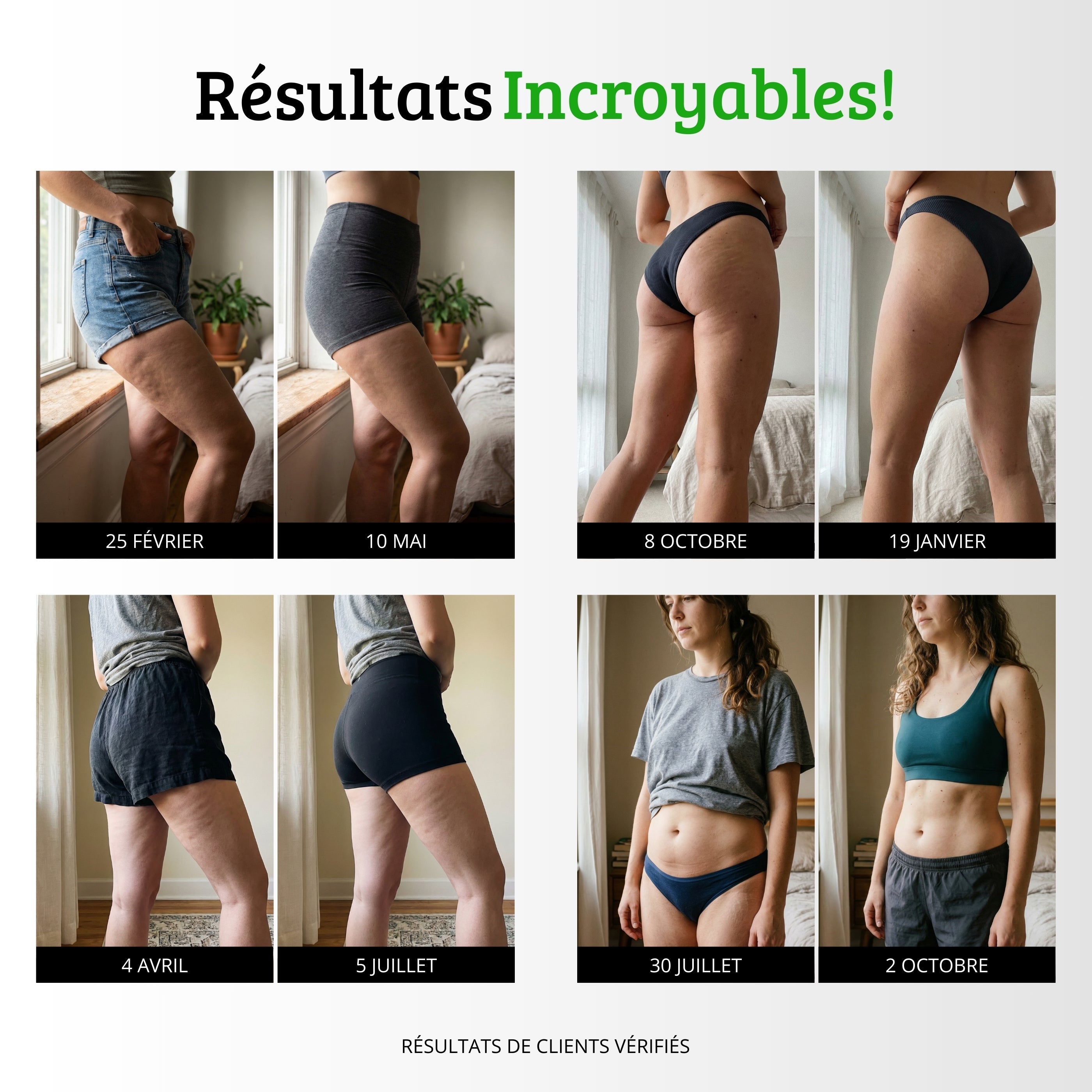 The Volu | RENOVIE — Tecnologie 3D Anti-Cellulite